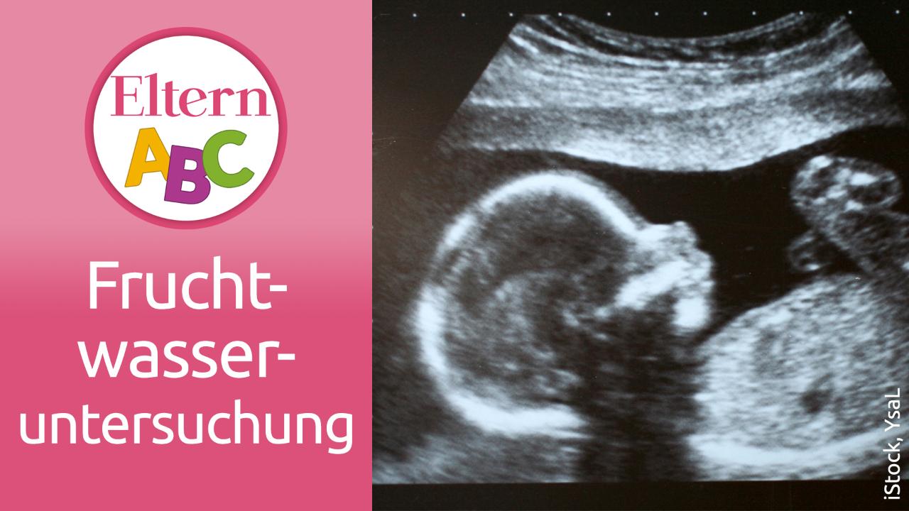 Fruchtwasseruntersuchung Alles Wichtige Urbia De